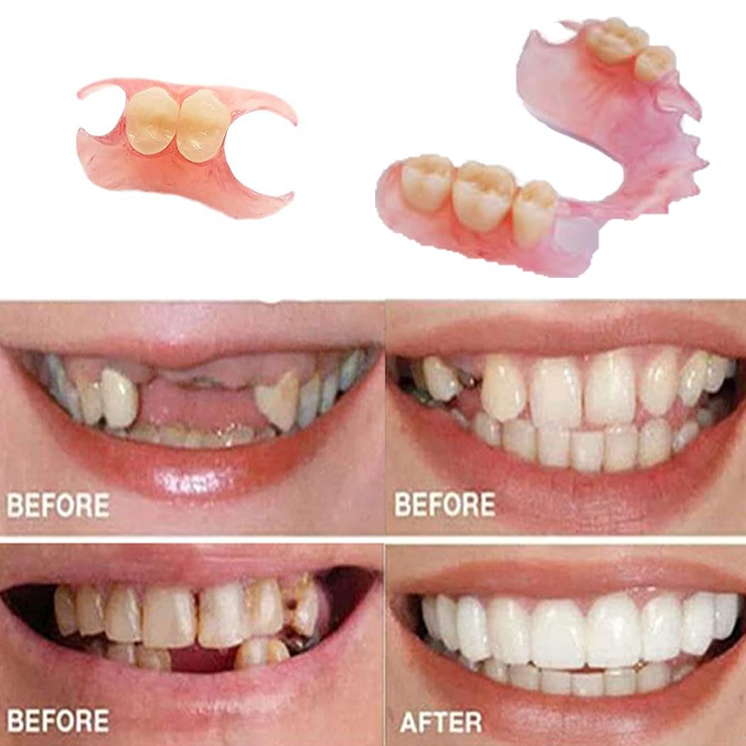 Fake Tooth Repair Kit V2839
